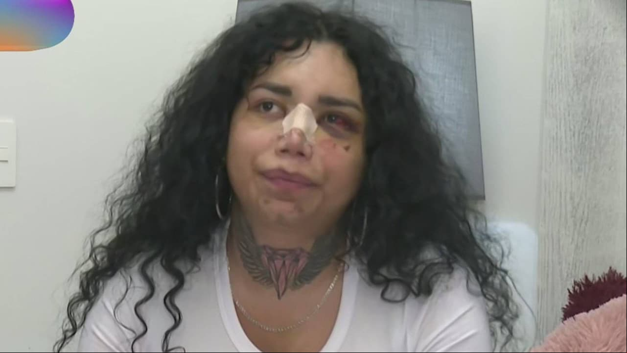 Paolita Suárez sorprende al revelar que ya perdonó a su expareja tras la agresión