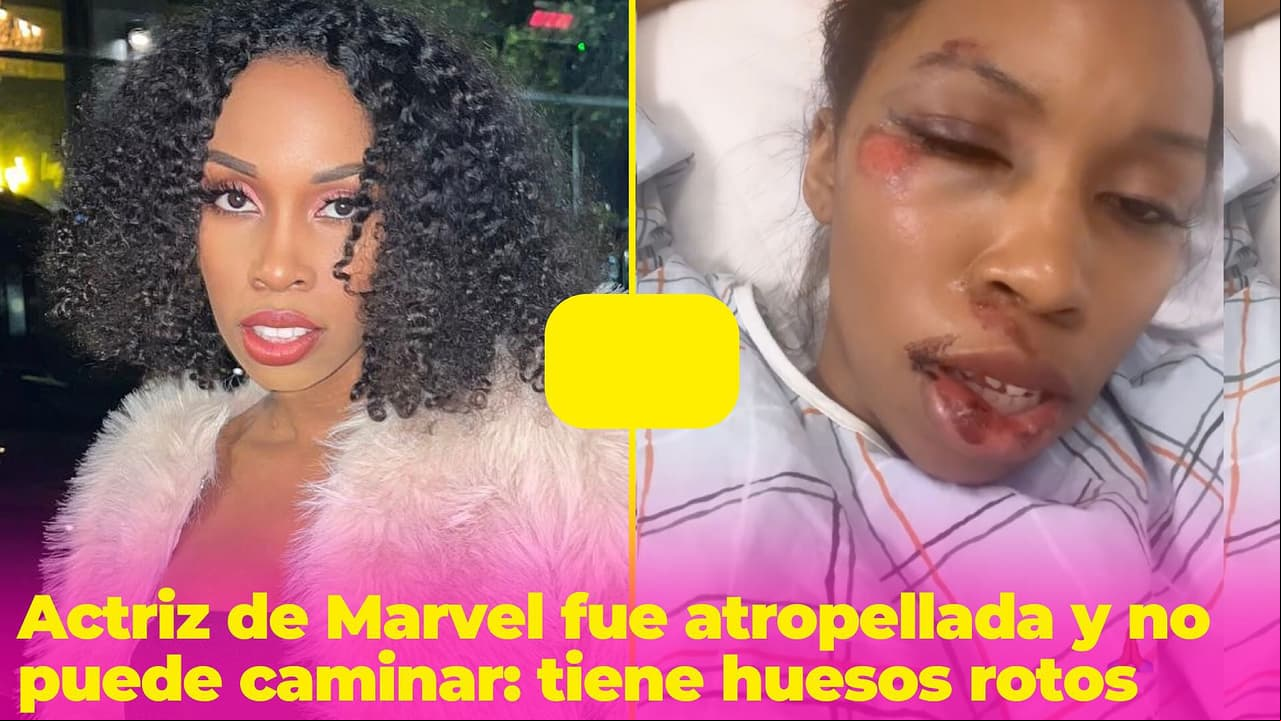 Carrie Bernans, actriz de Marvel, fue atropellada mientras comía y ahora no puede caminar