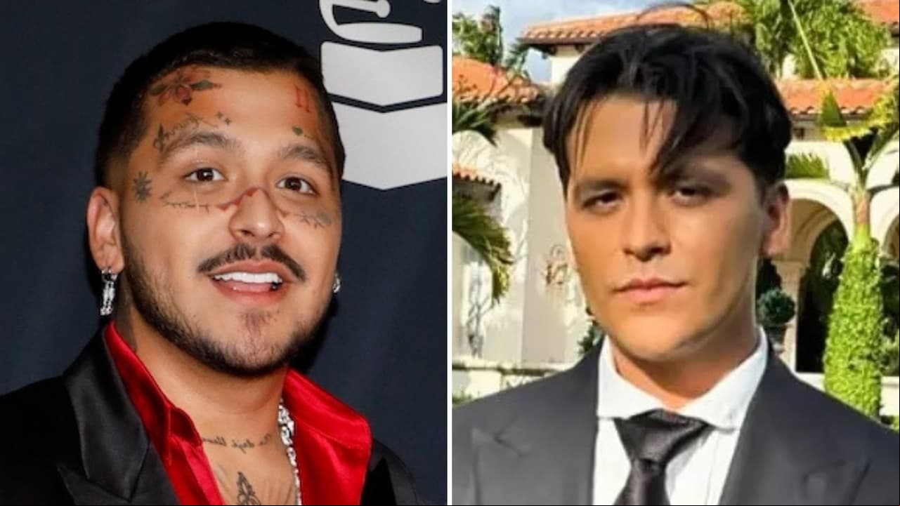 Nodal revela cómo le queda la piel del rostro tras quitarse los tatuajes: “Llagas, como si te quemaras”