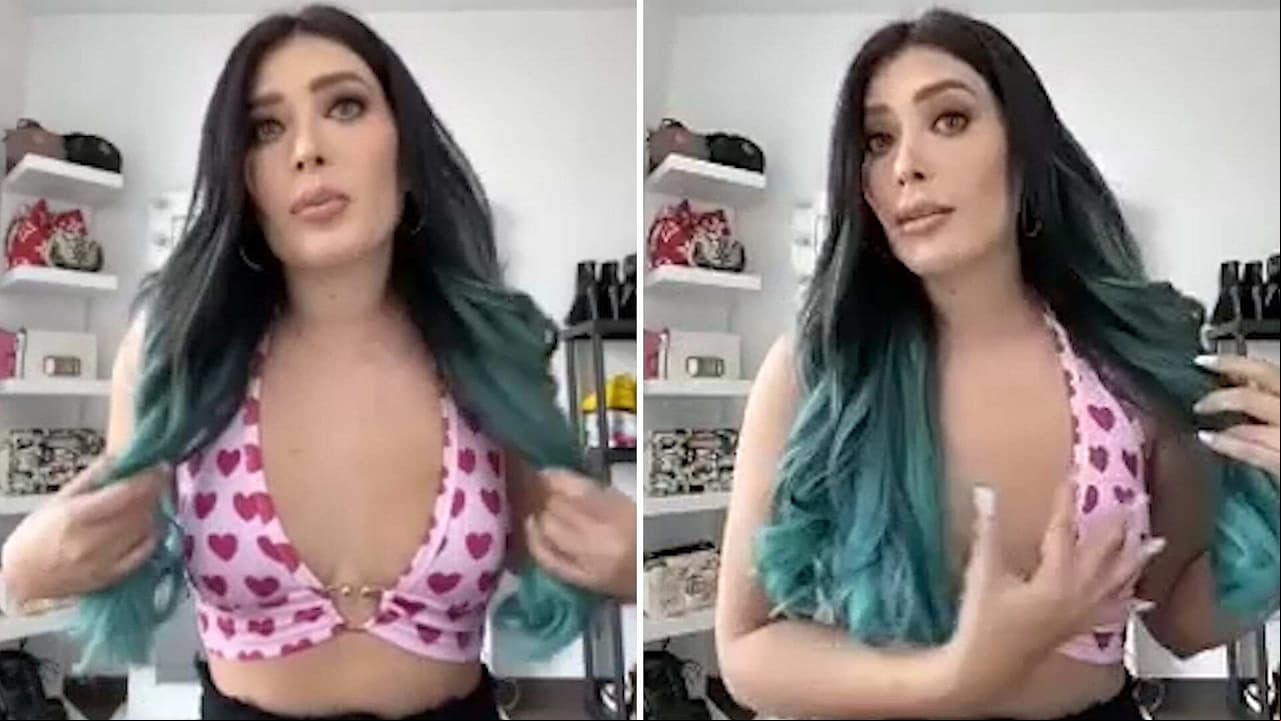 Brenda Zambrano de Acapulco Shore presume con orgullo su cicatriz tras quitarse los implantes de senos