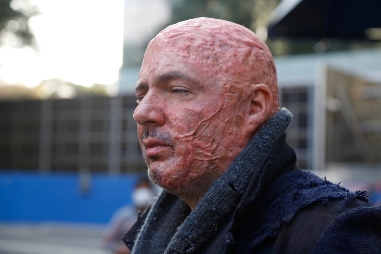 ¡Gonzalo reapareció! Tras ser atacado por unos hombres y quemado vivo, pudimos ver al gran villano todo desfigurado pidiendo limosna en la calle.