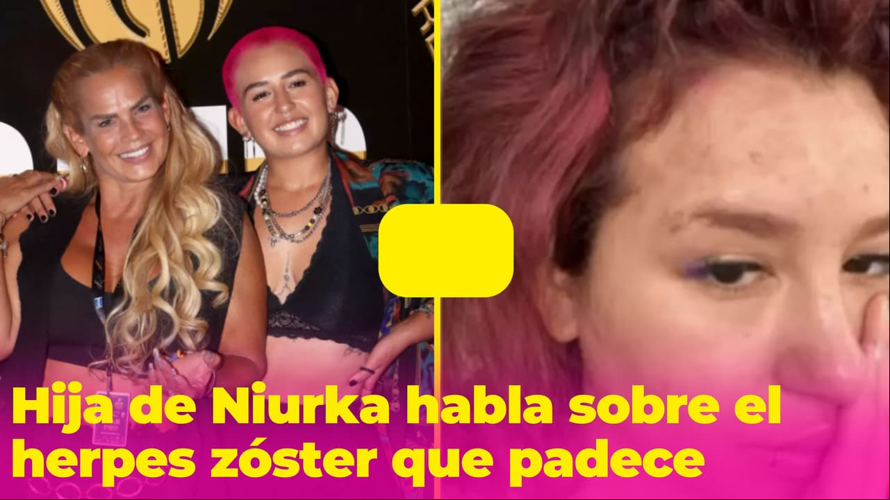 Romina, hija de Niurka, revela cómo está luchando contra la enfermedad que afectó su cara