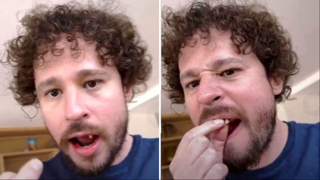 ¿A Luisito Comunica se le caen los dientes en plena transmisión en vivo? Video preocupa a fans