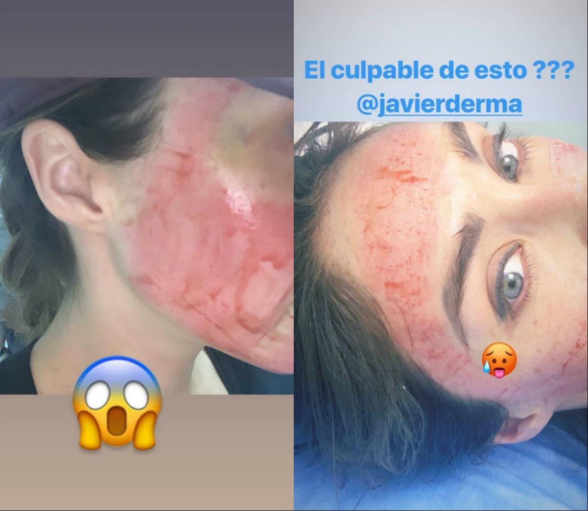 Anahí publicó las fotografías de su tratamiento estético en Instagram