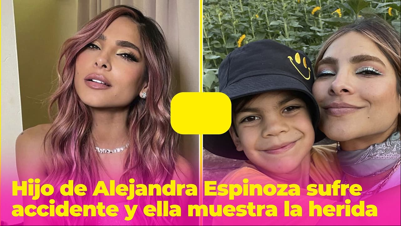 Matteo, hijo de Alejandra Espinoza, sufre un accidente y ella pide consejos para curar su herida