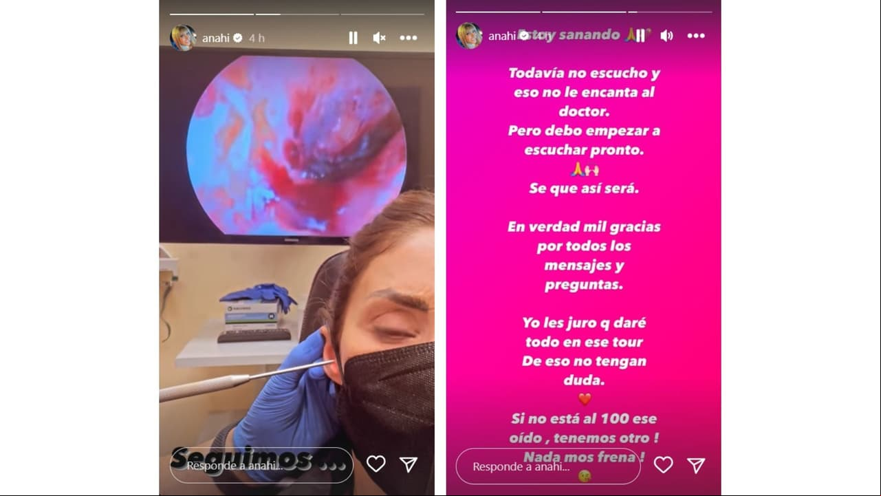 Anahí compartió cómo se encuentra su oído derecho.