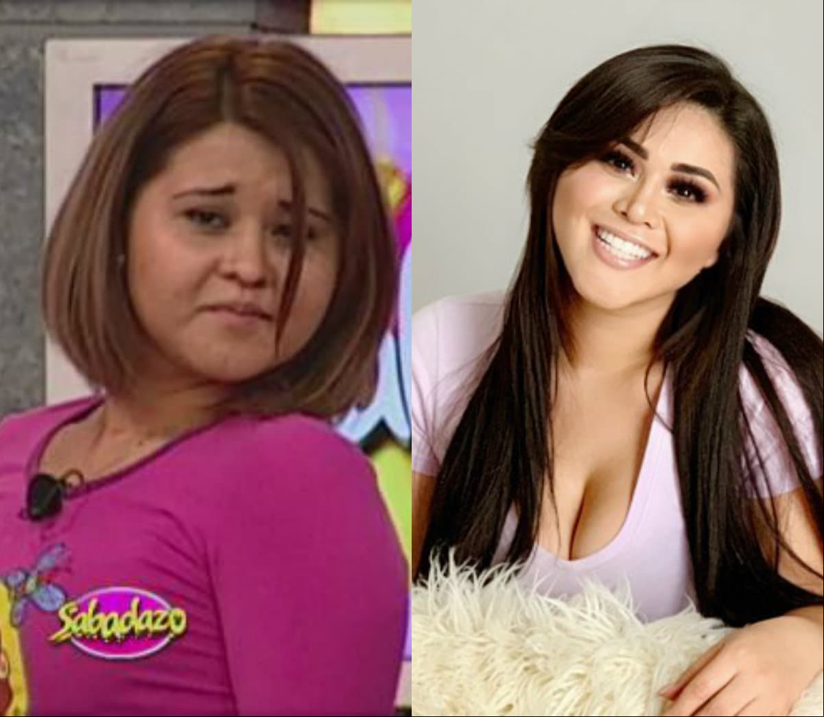 Gomita es un libro abierto y desde que saltó a la fama en el programa ‘Sabadazo’ habló sin tapujos de las cirugías plástica que se realizó para lucir espectacular.