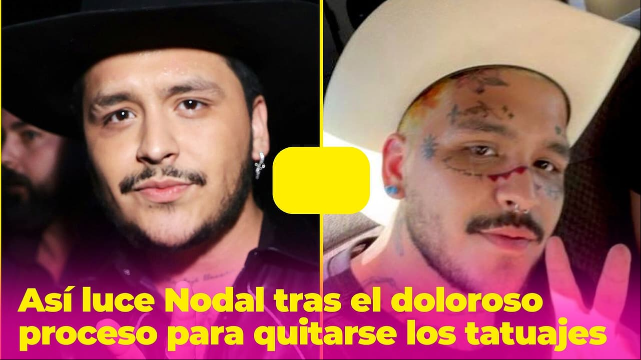 Así ha cambiado Nodal con el doloroso procedimiento para quitarse los tatuajes de la cara