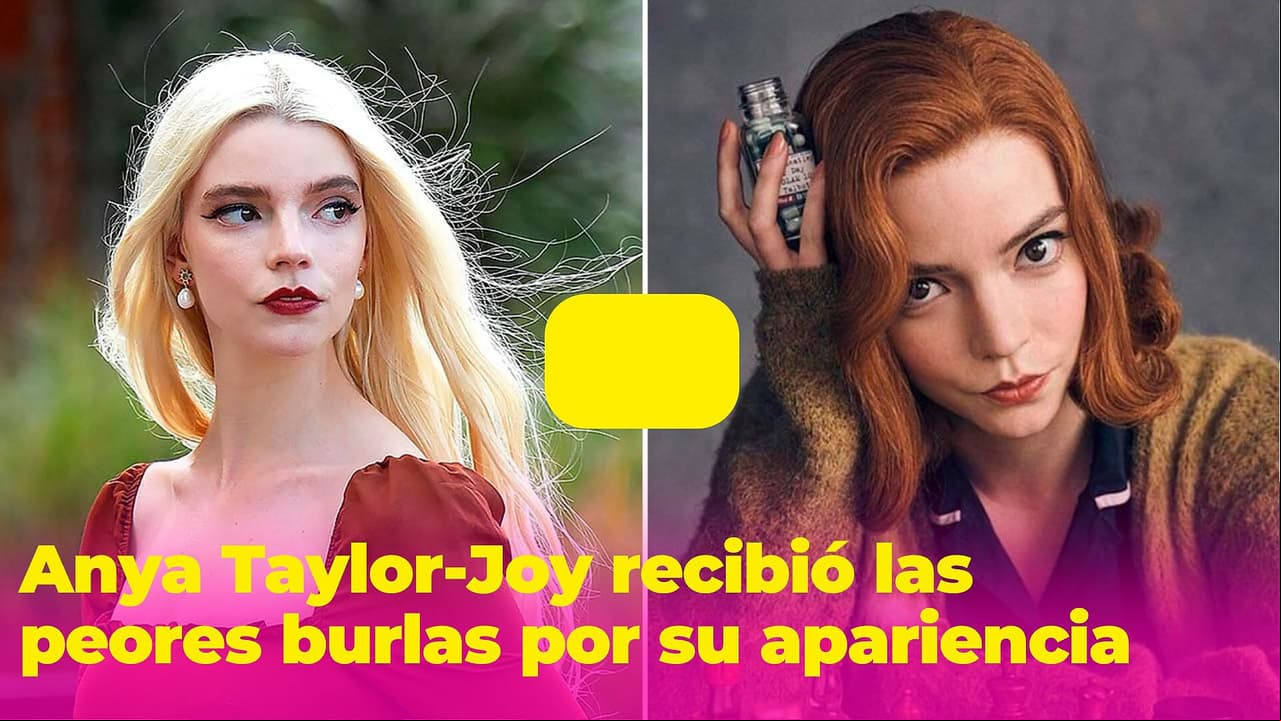 Anya Taylor-Joy soportó las burlas más crueles por su apariencia: no quería ni mirarse al espejo